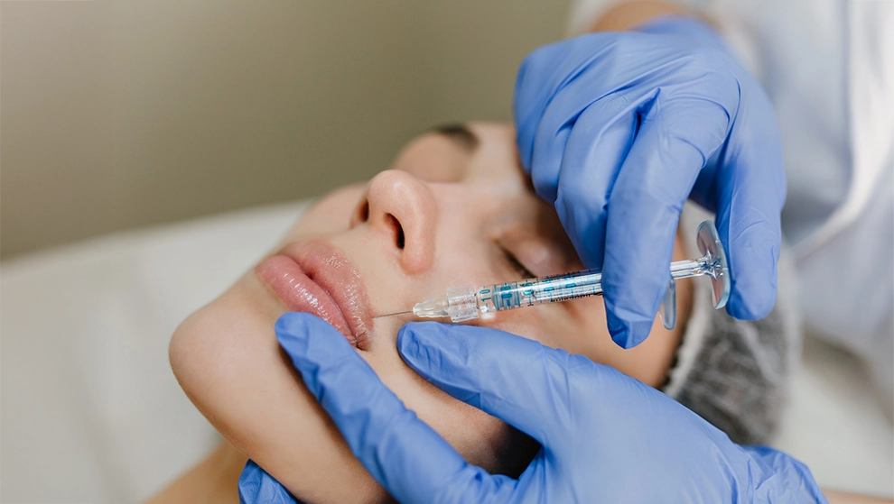 Lip Filler in Kartal - Natural Contours and Aesthetic Smiles