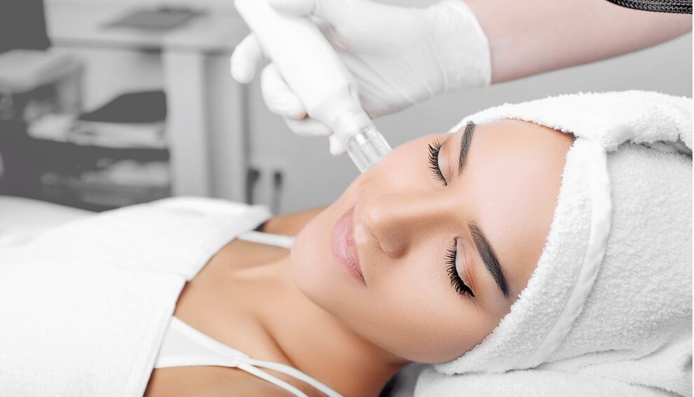 Gold Needle (Microneedle RF) Application in Maltepe